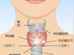 甲状腺结节忌口指南：碘盐能吃吗？海鲜要戒吗？答案全在这